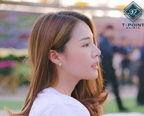 เสริมจมูกเชียงใหม่ที่ไหนดี