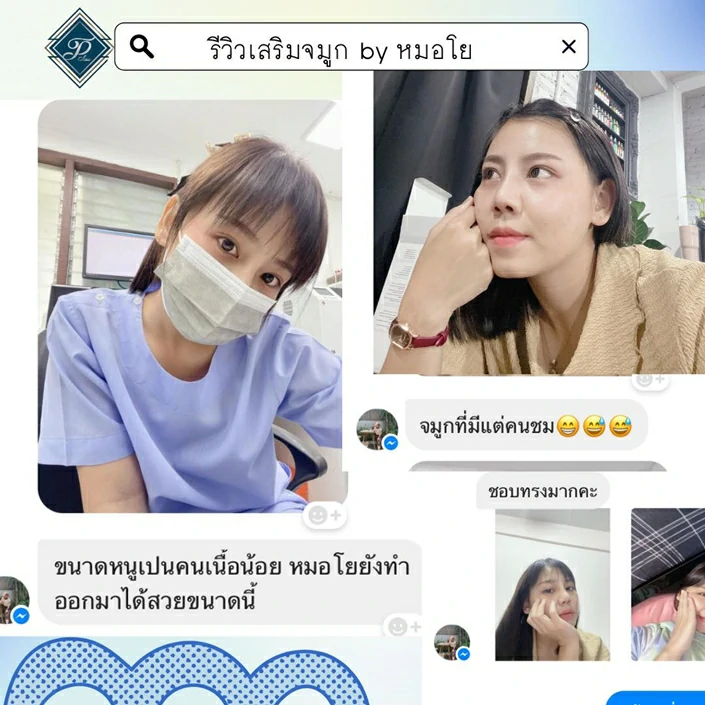 เสริมจมูก เชียงใหม่