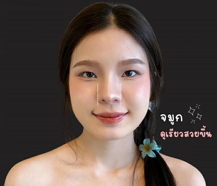 ทำจมูก เชียงใหม่