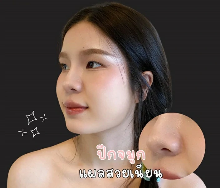 ทำจมูก เชียงใหม่