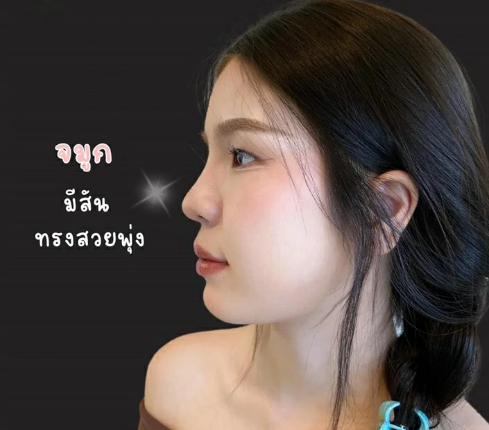 ทำจมูก เชียงใหม่