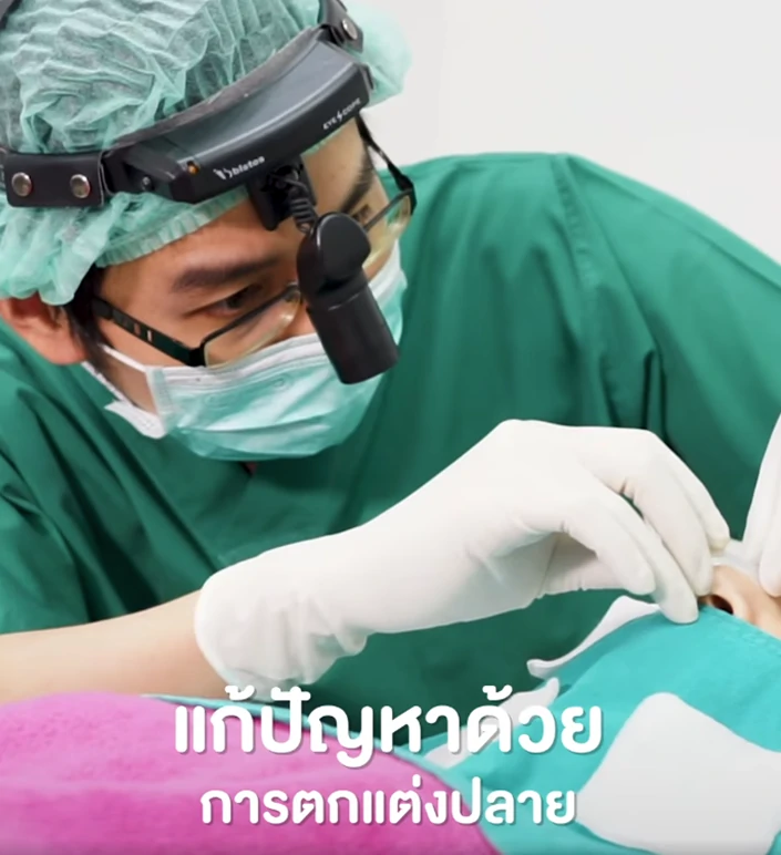 แก้จมูกเชียงใหม่