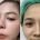 แก้จมูก