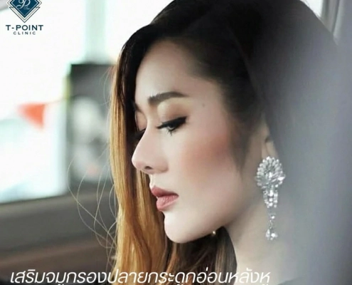 ศัลยกรรมจมูก เชียงใหม่