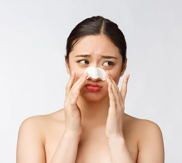 จมูกช้ำ