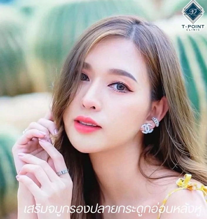 เสริมจมูก